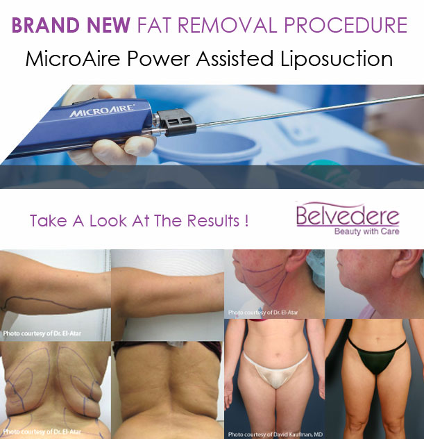 Liposuction - Fat Removal Surgery